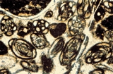 Foraminifera