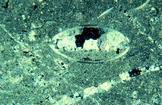 Ostracod