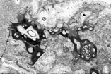 Bryozoans encrusted Tubiphytes