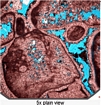 Micrite Envelope Unfilled